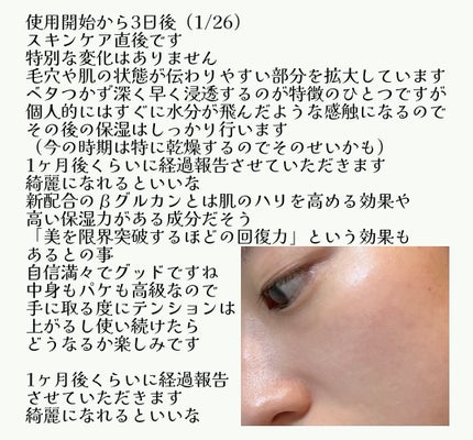 ジェニフィック アルティメ セラム/LANCOME/美容液を使ったクチコミ(2枚目)