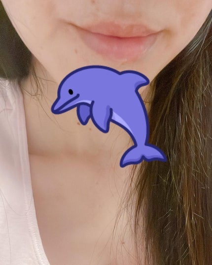 ニードルプランパー ほてりシアー/Ui2./リッププランパーを使ったクチコミ(4枚目)