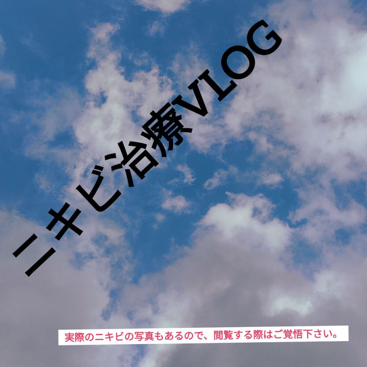 ワクチンの副作用でバテてらたこんなにニキビが😖💦

てことで、ニキビが治るまでの経過を投稿していきます。

使うスキンケア用品は、

①アロエジェル　98%
②白潤
③皮膚科の薬

これを基本にしてやってみます。

いつもはinnisf