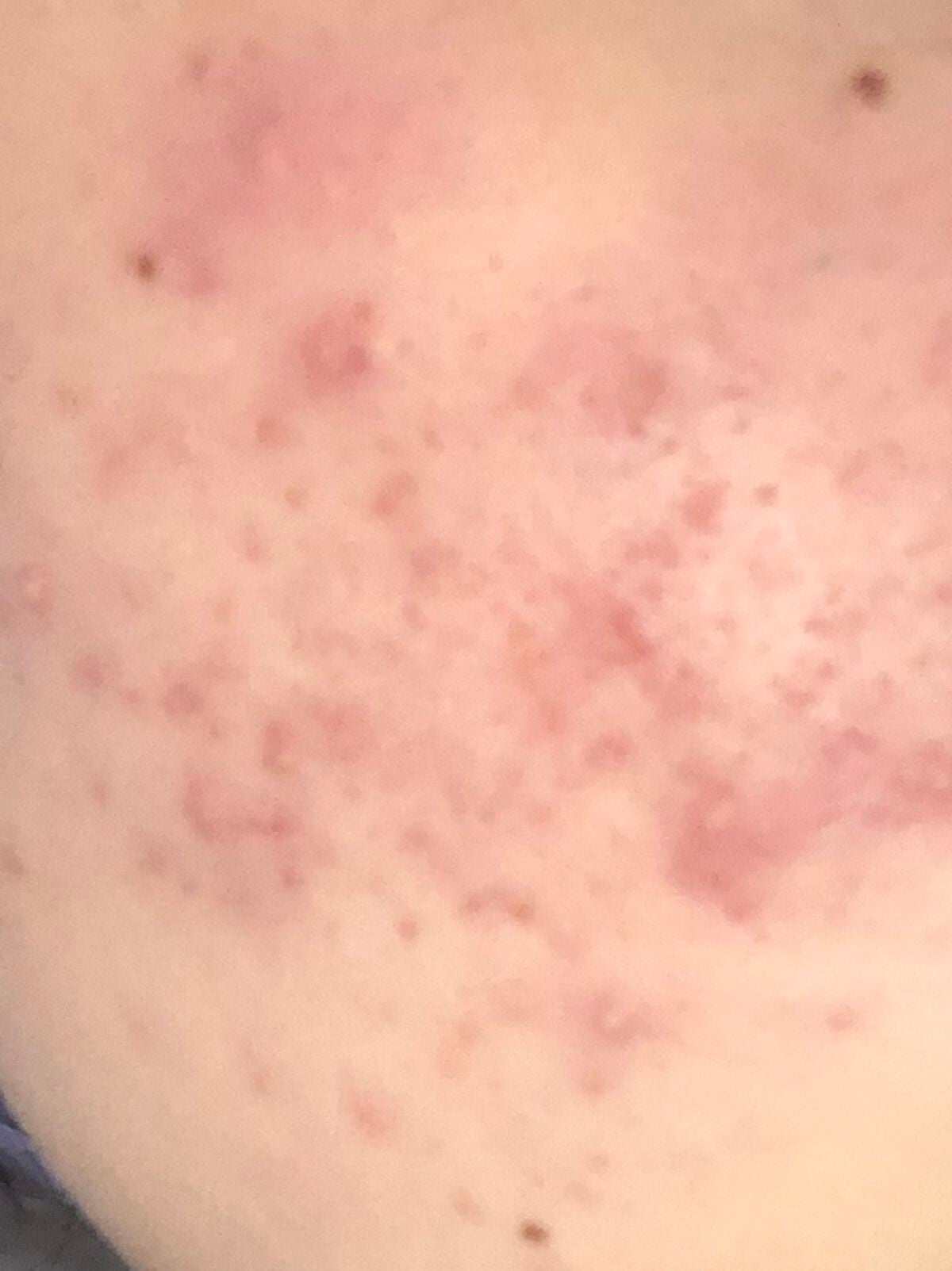 ハトムギ化粧水(ナチュリエ スキンコンディショナー R )/ナチュリエ/化粧水を使ったクチコミ(1枚目)