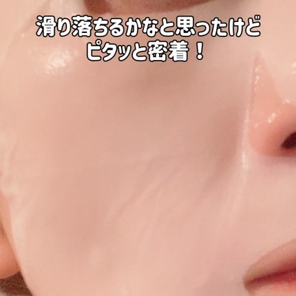 ガムシートマスクドクダミステッカー/Abib /シートマスク・パックを使ったクチコミ(5枚目)