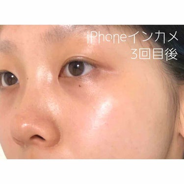 ayn☔︎ on LIPS 「実際どうなの？フェイシャルで春の肌改善💆🏻‍♀️✨今回はフェイ..」（3枚目）