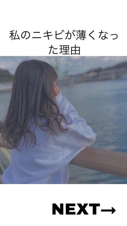レッドティーツリーシカソサイドソリューショントナー/SOME BY MI/化粧水を使ったクチコミ(1枚目)