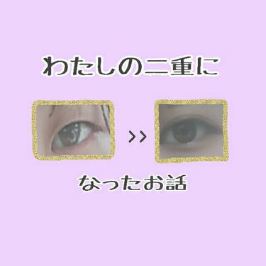 アイテープ（絆創膏タイプ、レギュラー、７０枚）/DAISO/二重まぶた用アイテムを使ったクチコミ（1枚目）