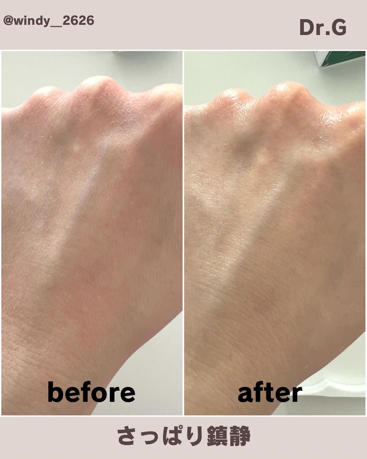 レッドブレミッシュ クリアスージングトナー/Dr.G/化粧水を使ったクチコミ(4枚目)