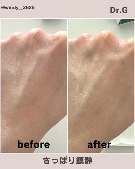 レッドブレミッシュ クリアスージングトナー/Dr.G/化粧水を使ったクチコミ(4枚目)