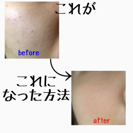 潤浸保湿 フェイスクリーム/キュレル/フェイスクリームを使ったクチコミ(1枚目)