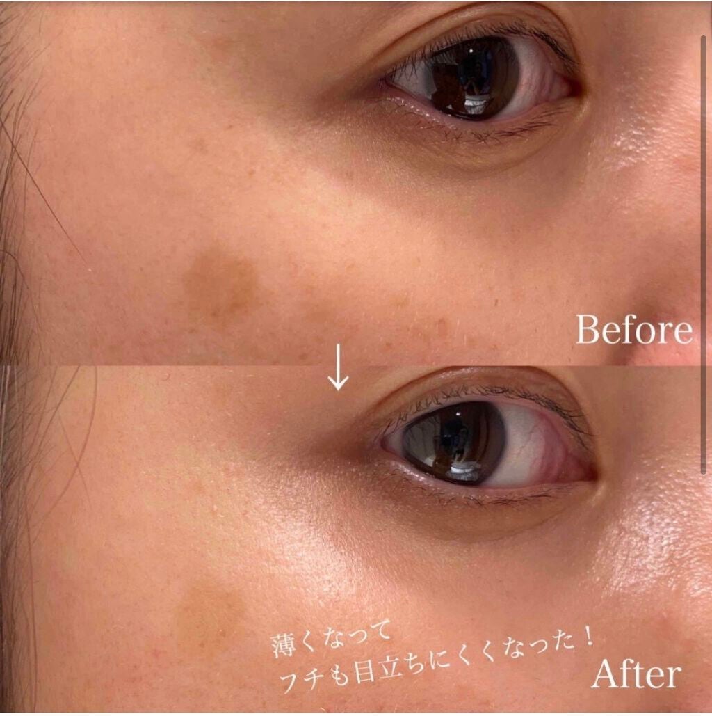 ホワイトルーセント イルミネーティング マイクロS セラム/SHISEIDO/美容液を使ったクチコミ(4枚目)