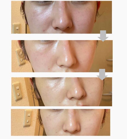 薬用しみ対策 保湿クリーム/メラノCC/フェイスクリームを使ったクチコミ(3枚目)