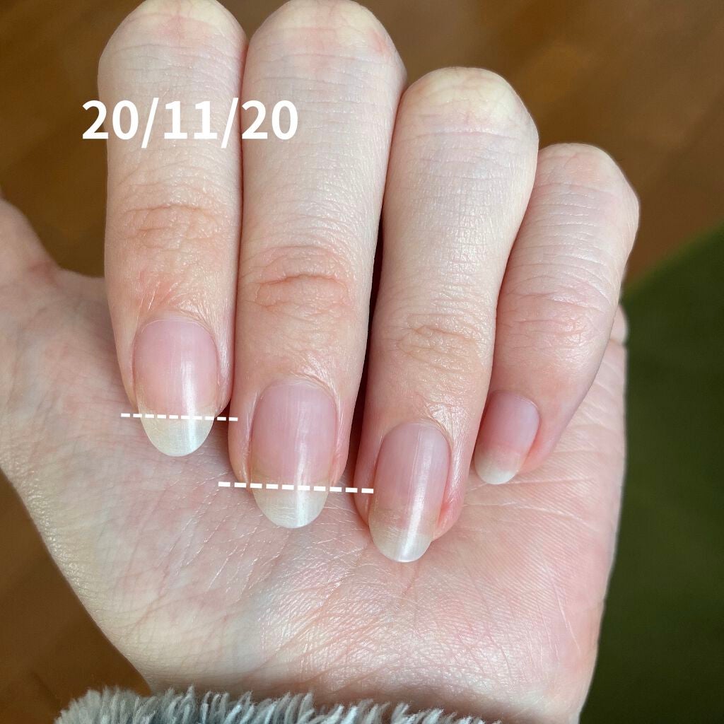 キューティクルオイル/HOMEI/ネイルオイル・トリートメントを使ったクチコミ(5枚目)