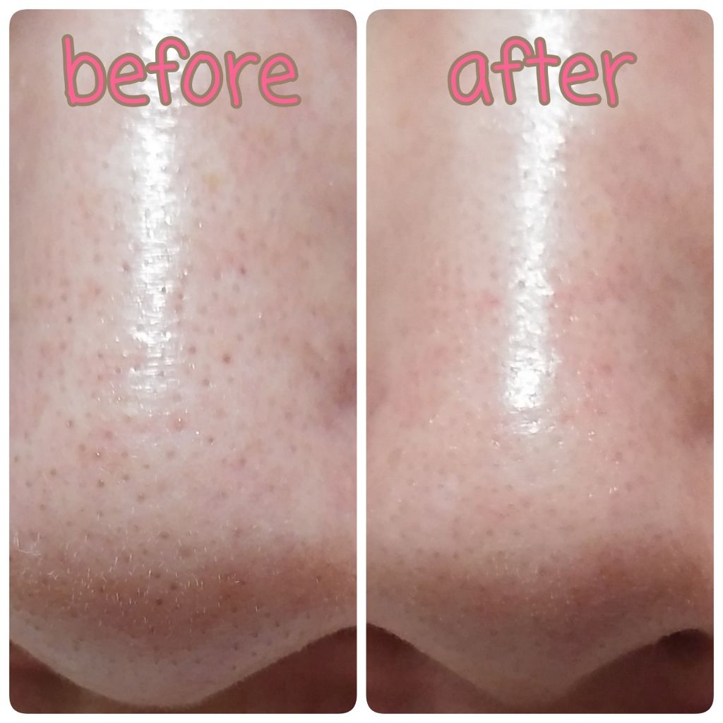 シラクル ビューティシート/Ciracle/トナーパッドを使ったクチコミ（1枚目）