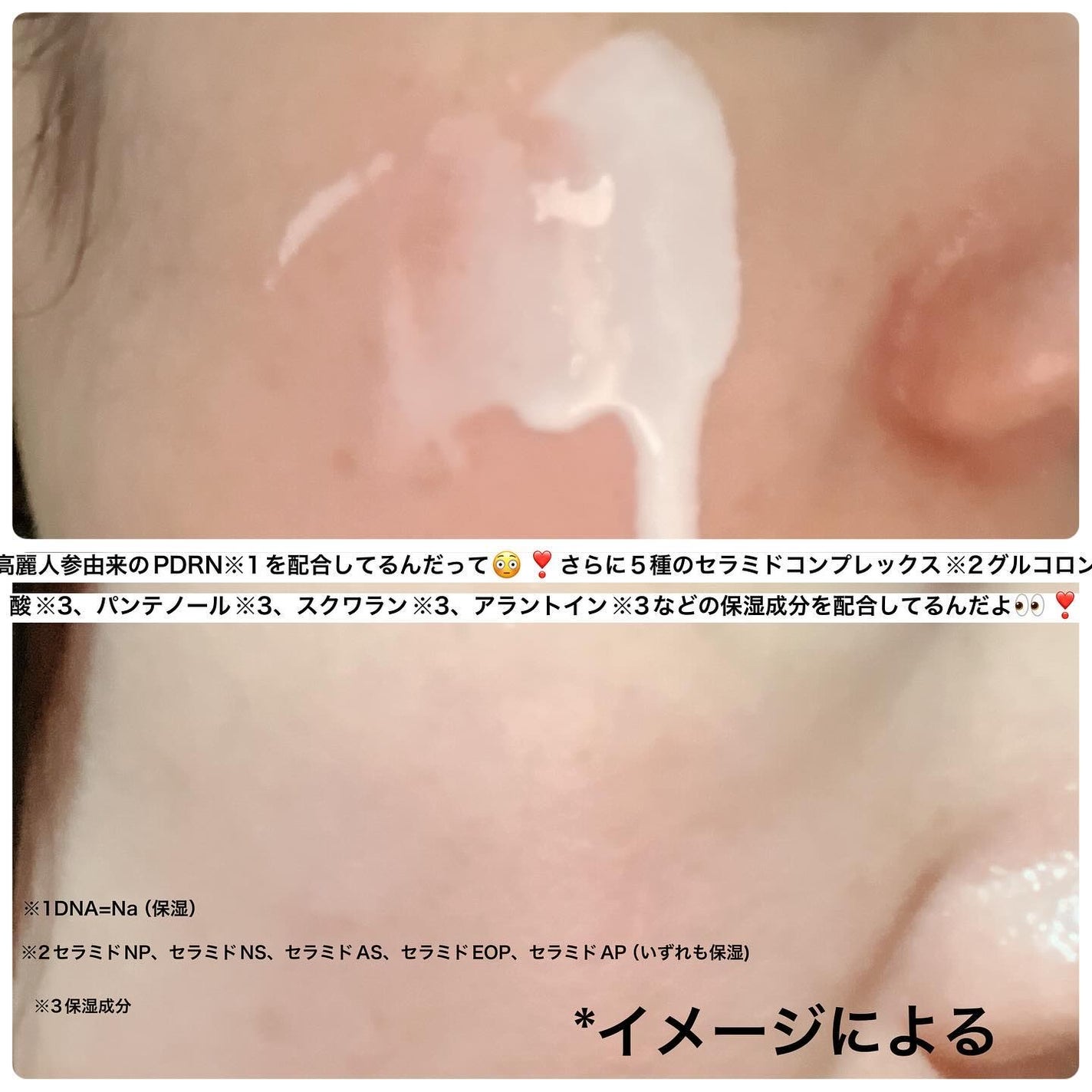 ピーディーアールエヌエッセンス PDRN 100/VT/美容液を使ったクチコミ(7枚目)