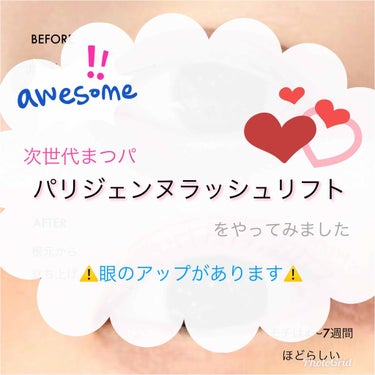 
次世代まつパのパリジェンヌラッシュリフトのレポです。
店員さんに聞いたことをまとめます。


🍣従来のまつパとの違い🍣

① 使う薬剤が比較的やさしい
② 根元がカクッとならずに緩やかに立ちあがる
③