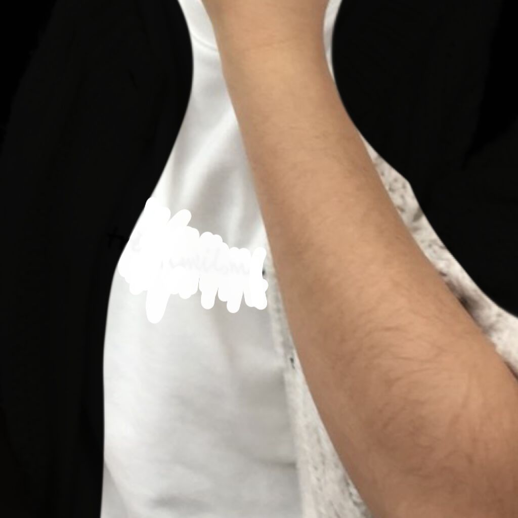 FASIZ607C IPL光脱毛器/FASIZ/家庭用脱毛器を使ったクチコミ（2枚目）