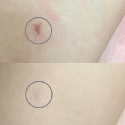 CHANEL ル コレクトゥール ドゥ シャネルのクチコミ「しっとりとした質感のコンシーラーです。
クマ、シミ隠しに使用しています。
肌にピターーーーー.....」(2枚目)