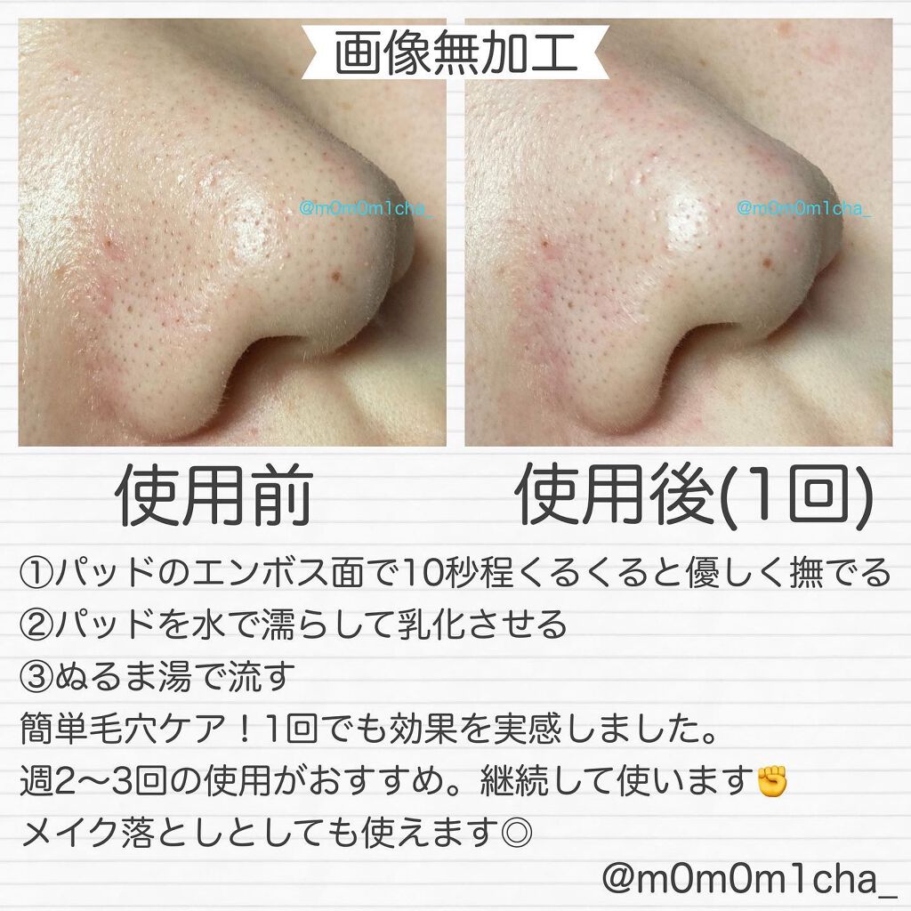 ブラックヘッド ピュア クレンジング オイル キルパッド/manyo/トナーパッドを使ったクチコミ(4枚目)