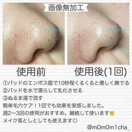 ブラックヘッド ピュア クレンジング オイル キルパッド/manyo/トナーパッドを使ったクチコミ(4枚目)