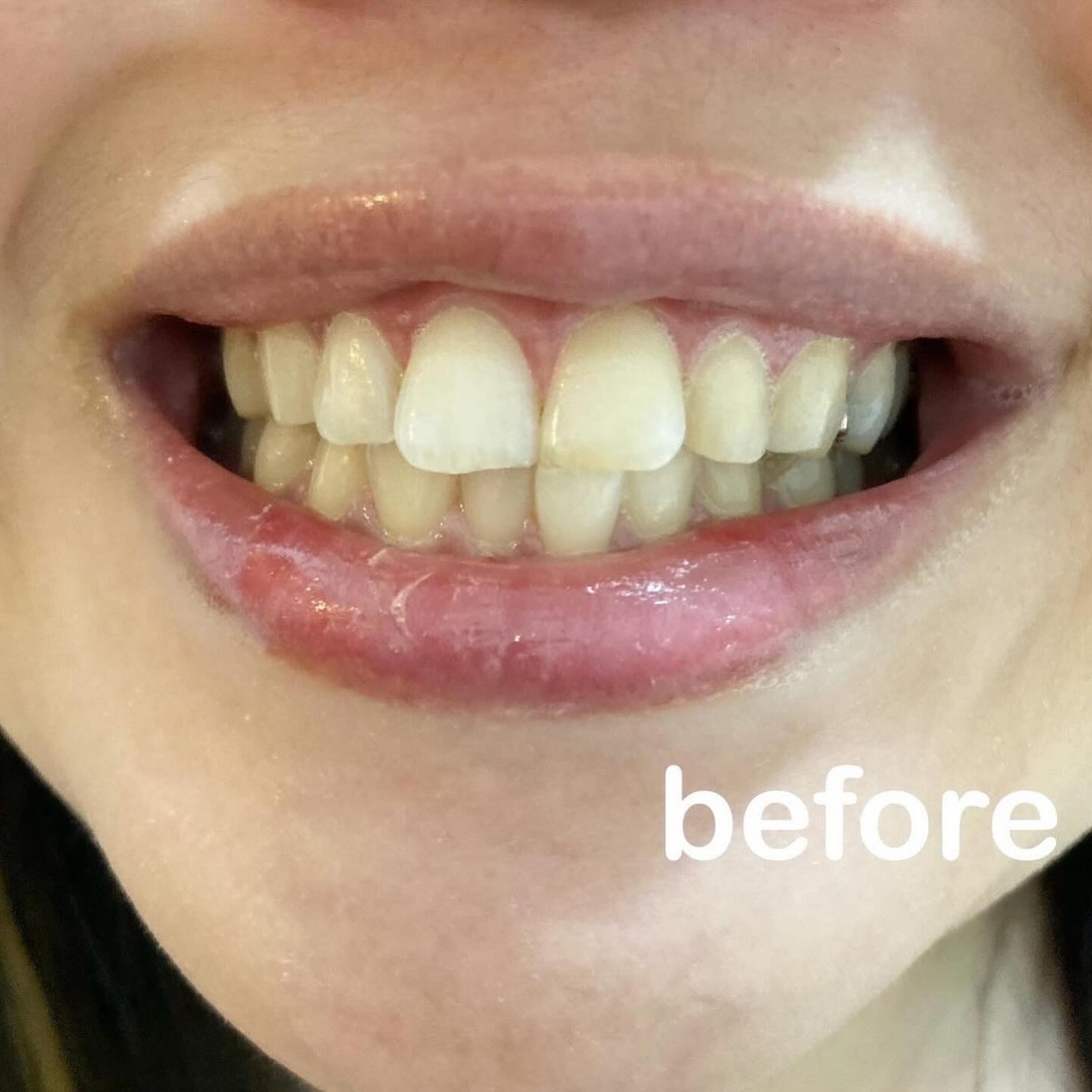 DENTA ONE/シーヴァ/その他を使ったクチコミ(4枚目)