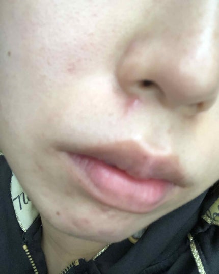 ハトムギエキス化粧水/プラチナレーベル/化粧水を使ったクチコミ(2枚目)