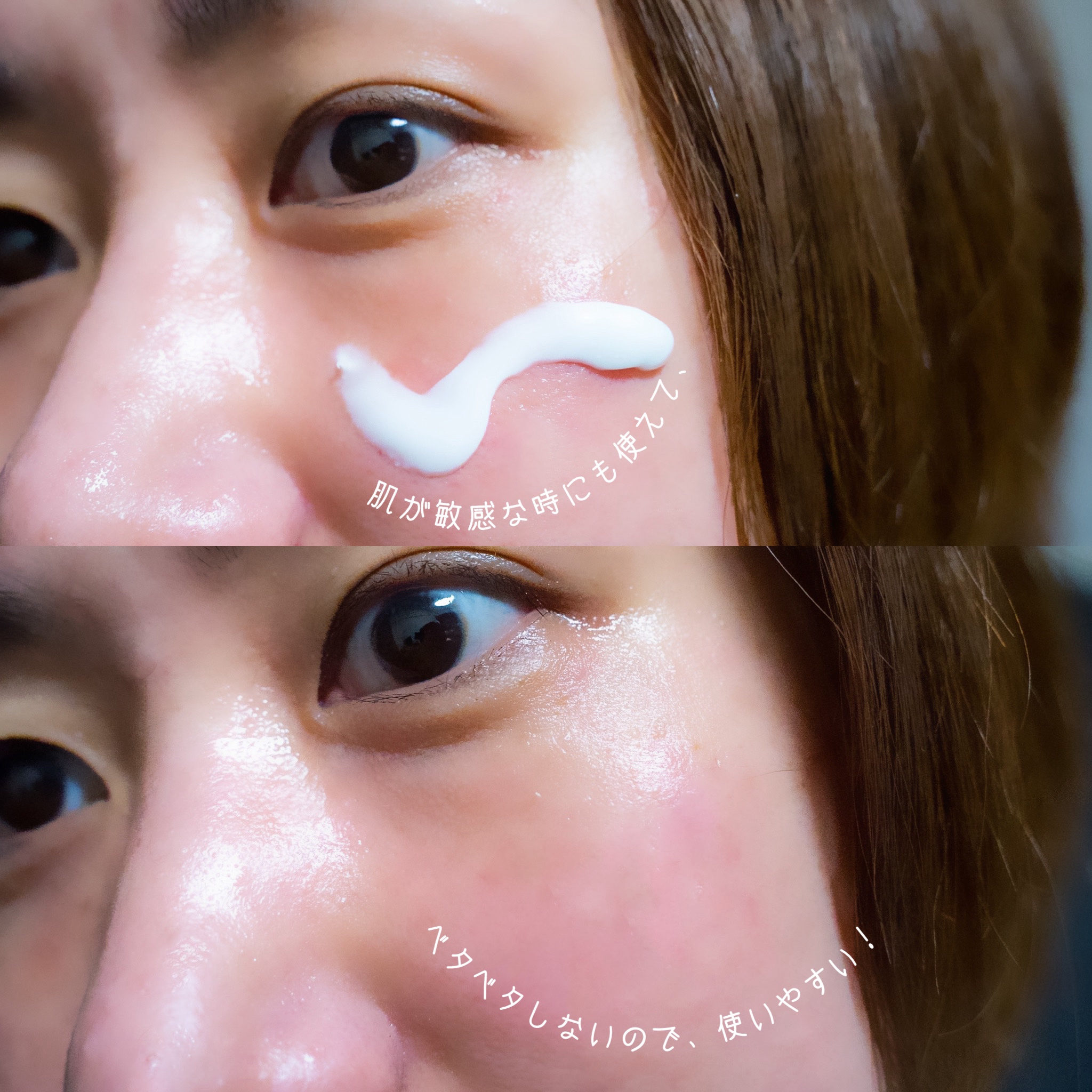 シカルファットプラス リペアクリーム/アベンヌ/フェイスクリームを使ったクチコミ（3枚目）