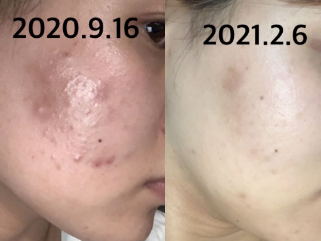 を使ったクチコミ（1枚目）