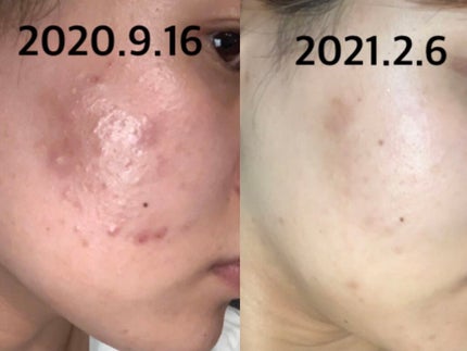 を使ったクチコミ(1枚目)