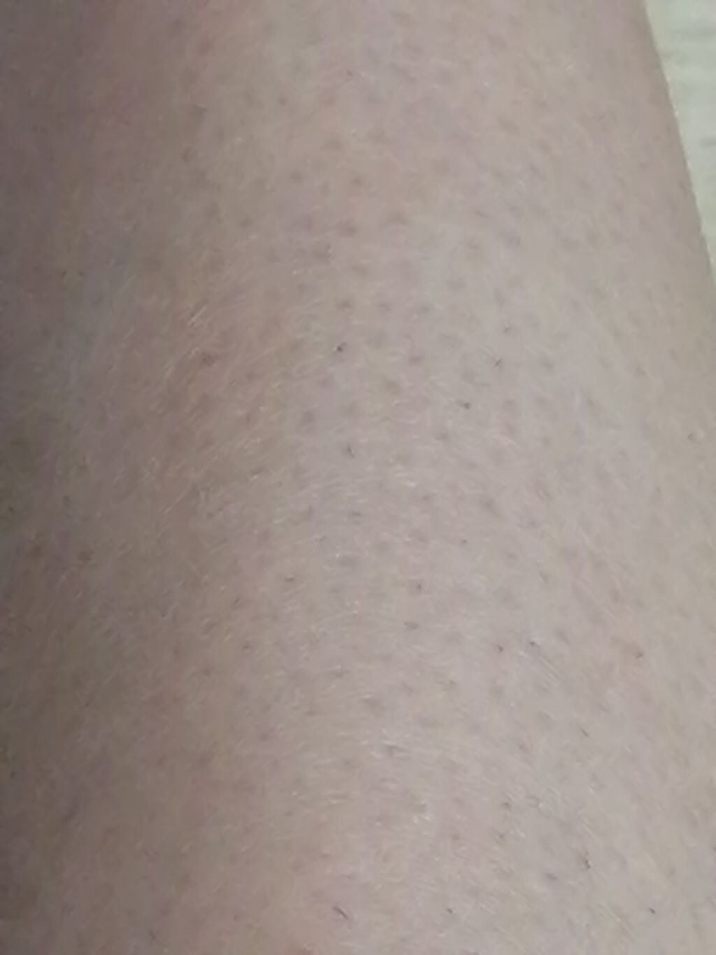 除毛クリーム シトラスホワイトリリィ/スリンキータッチ セルフスパ/除毛クリームを使ったクチコミ(2枚目)