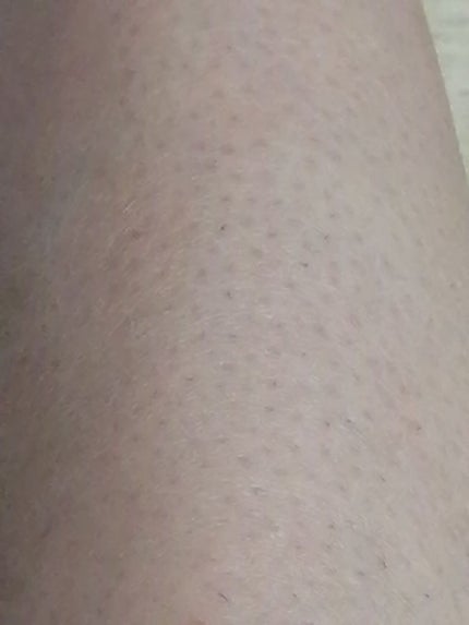 除毛クリーム シトラスホワイトリリィ/スリンキータッチ セルフスパ/除毛クリームを使ったクチコミ(2枚目)