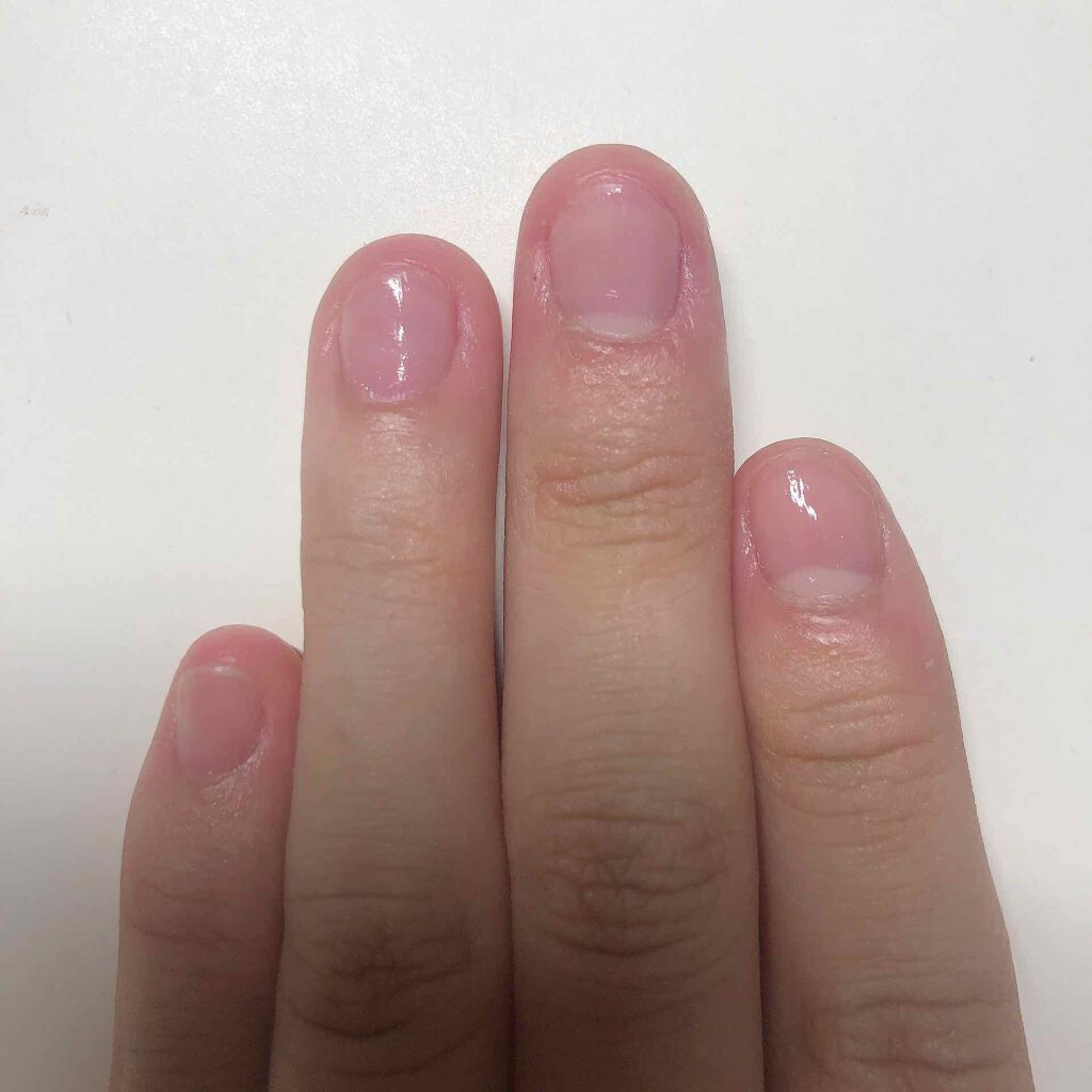 アトリックス ハンドジェル/アトリックス/ハンドジェルを使ったクチコミ(2枚目)