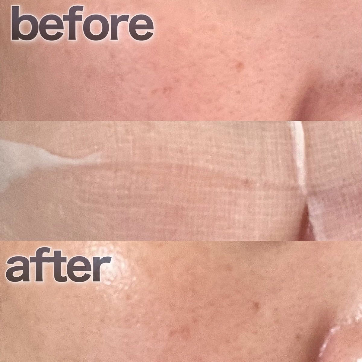 ブルーブライトマスク/EMROSÉ/シートマスク・パックを使ったクチコミ(3枚目)