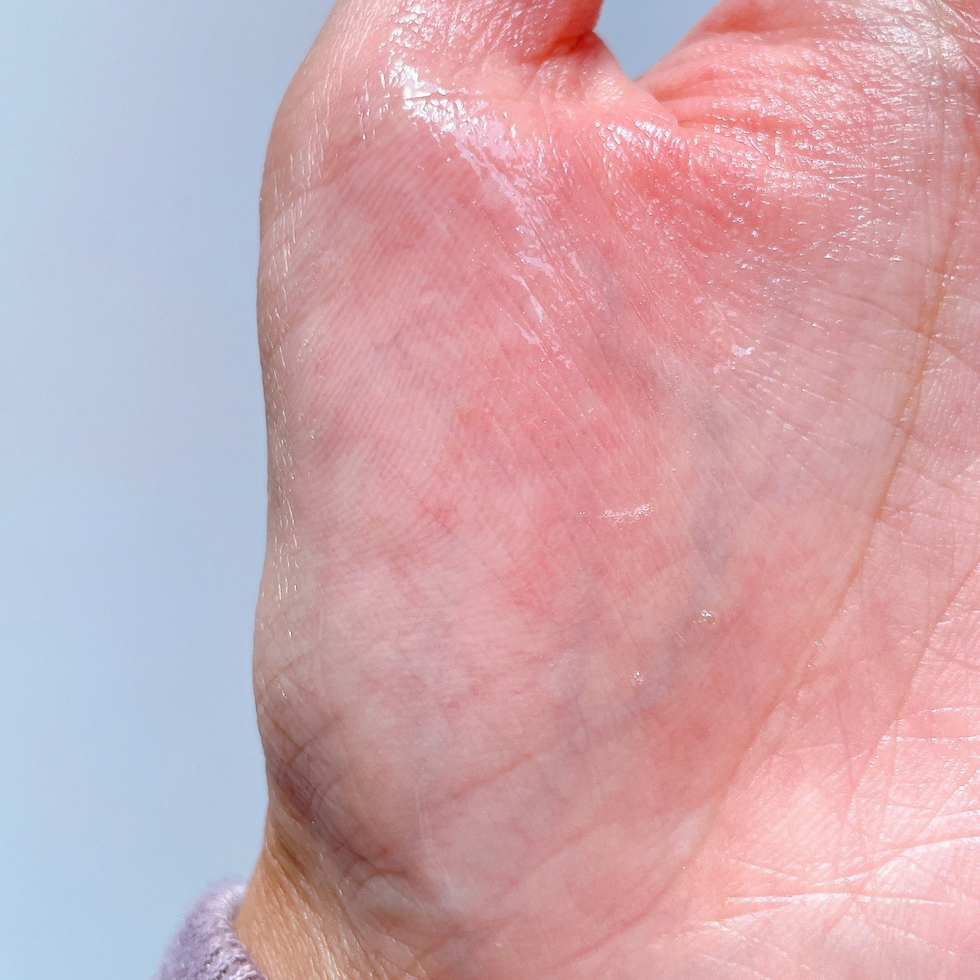 アクアヒアルロニックエッセンス/ロベクチン/化粧水を使ったクチコミ(3枚目)