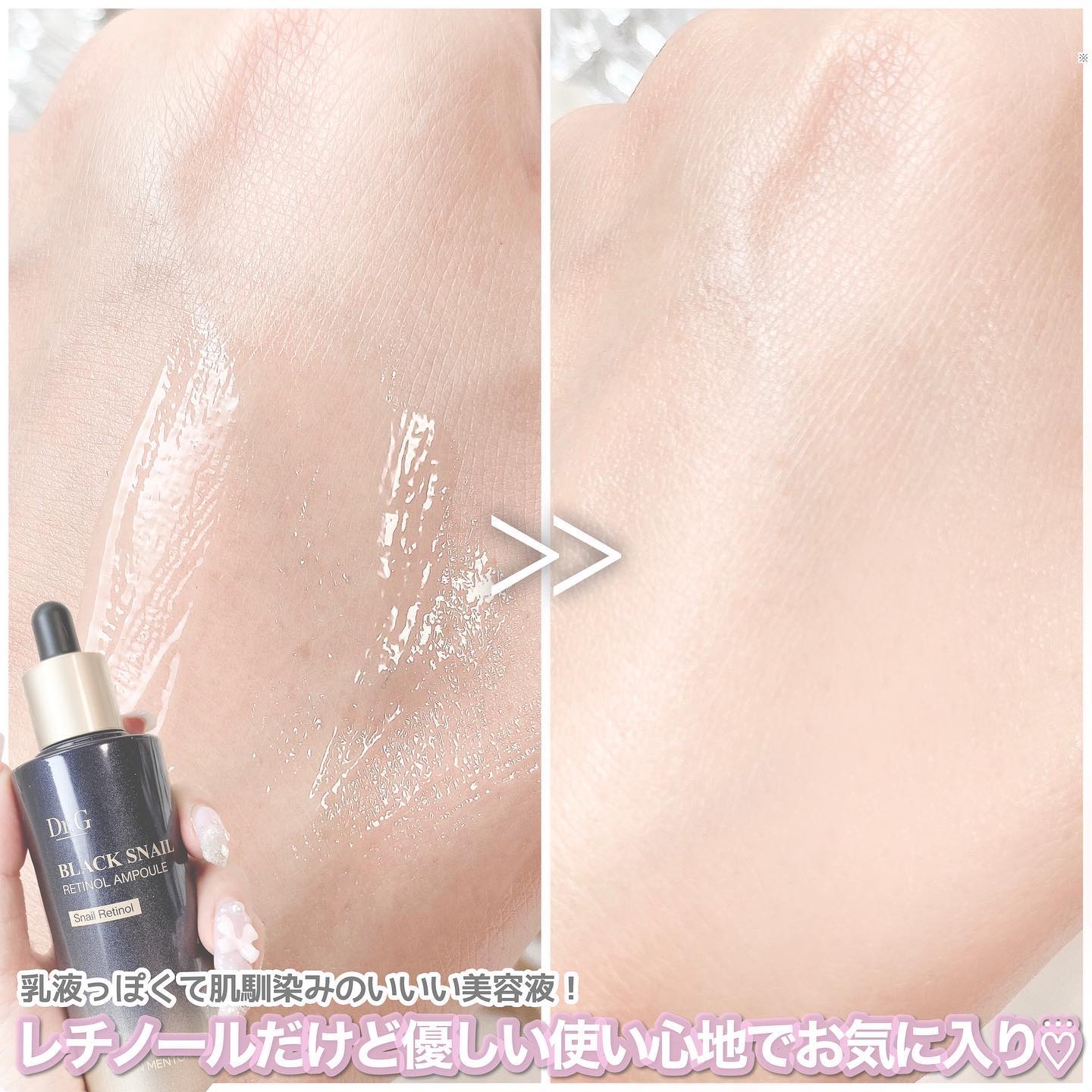 ロイヤルブラックスネイルクリーム/Dr.G/フェイスクリームを使ったクチコミ（3枚目）