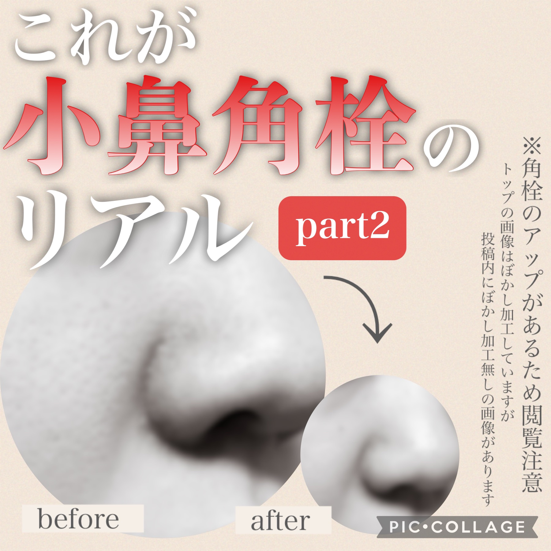 ケアセラ APフェイス＆ボディ乳液/ケアセラ/ボディミルクを使ったクチコミ（1枚目）