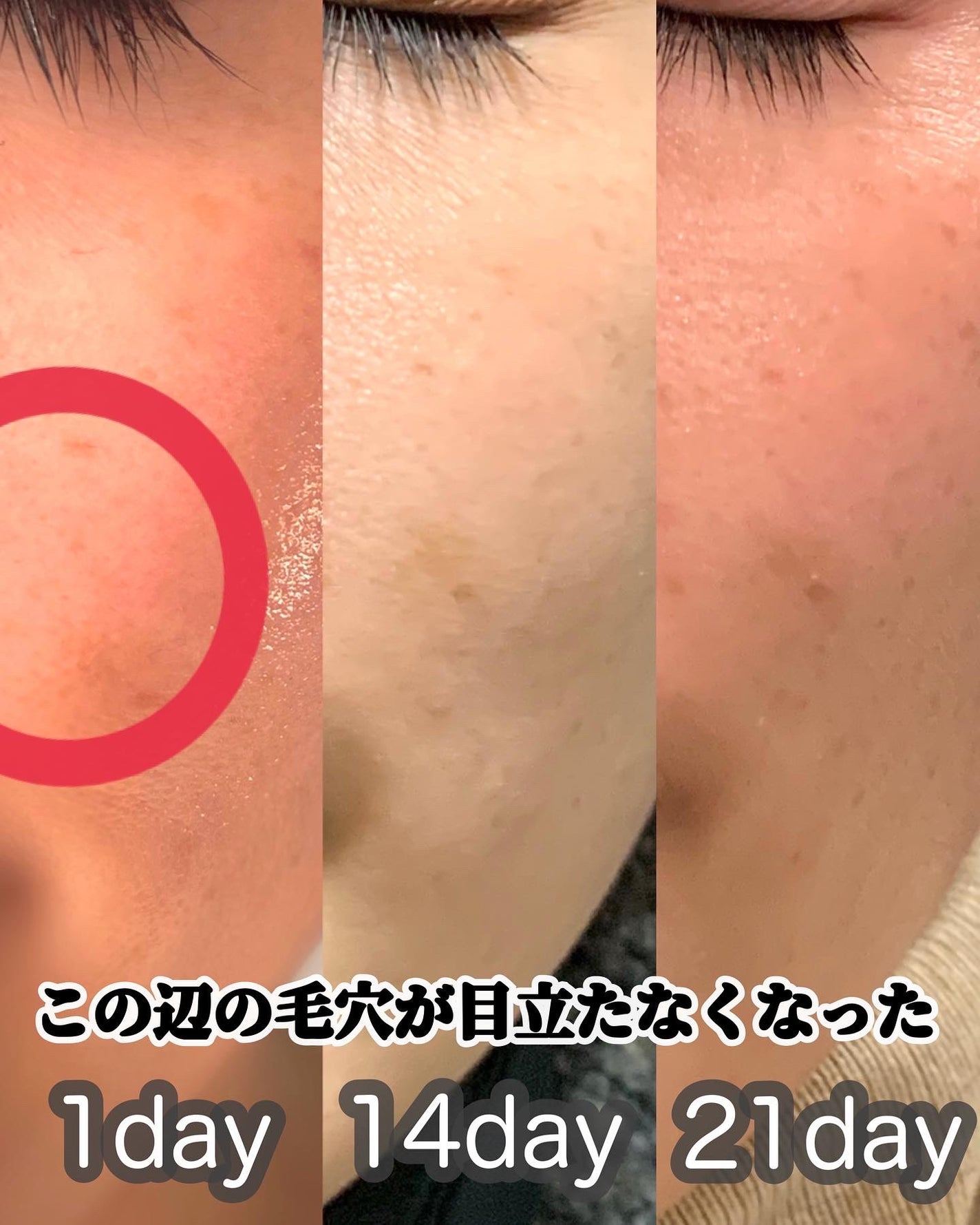 ビタペアC ビタレチ美容液/ネイチャーリパブリック/美容液を使ったクチコミ(7枚目)