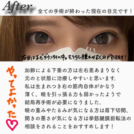 Fabulous(ファビュラス)1month GLASS BROWN(グラスブラウン)/FABUROUS/カラーコンタクトレンズの画像