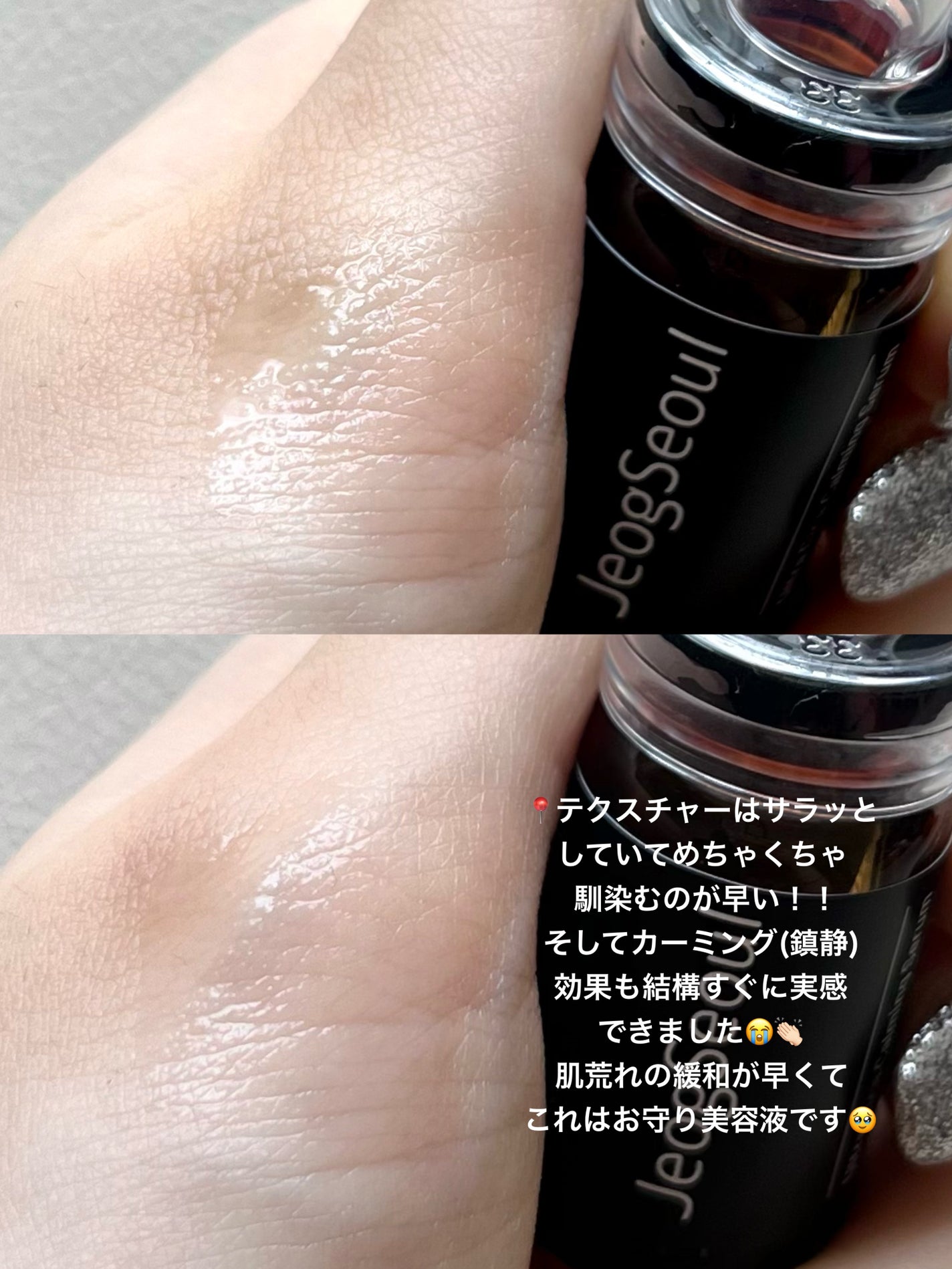 ウルトラシカ カーミングセラム/JeogSeoul/美容液を使ったクチコミ(3枚目)