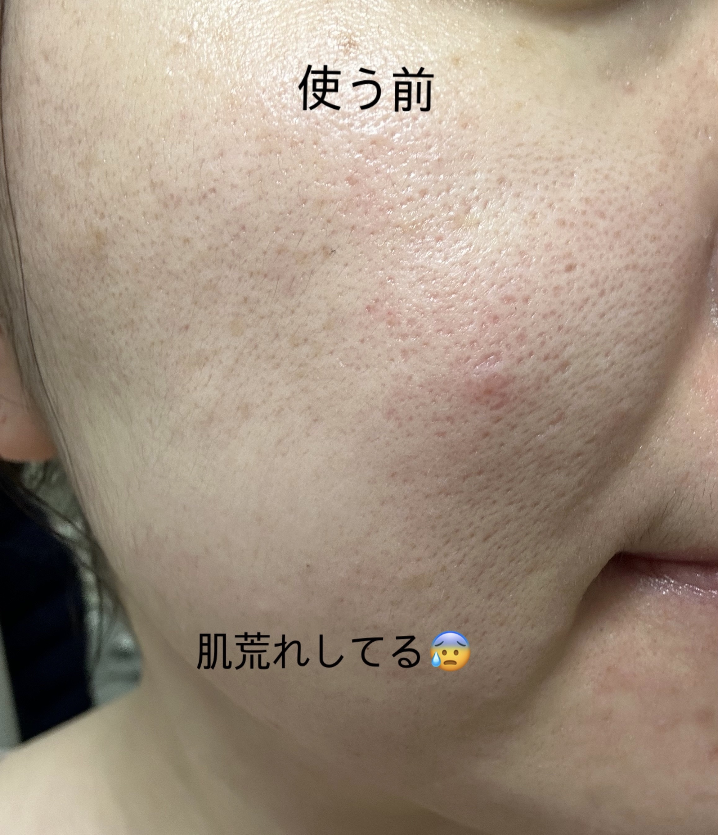 レチノール スーパーバウンス セラム/IOPE/美容液を使ったクチコミ（3枚目）