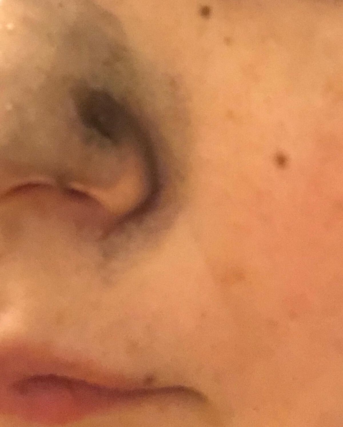 プレミアム 毛穴角栓ジェル/メルティベリー/スクラブ・ゴマージュを使ったクチコミ(5枚目)