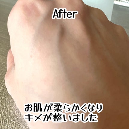 BHA CAPSULE NON COMEDO TONER/23years old/化粧水を使ったクチコミ(4枚目)