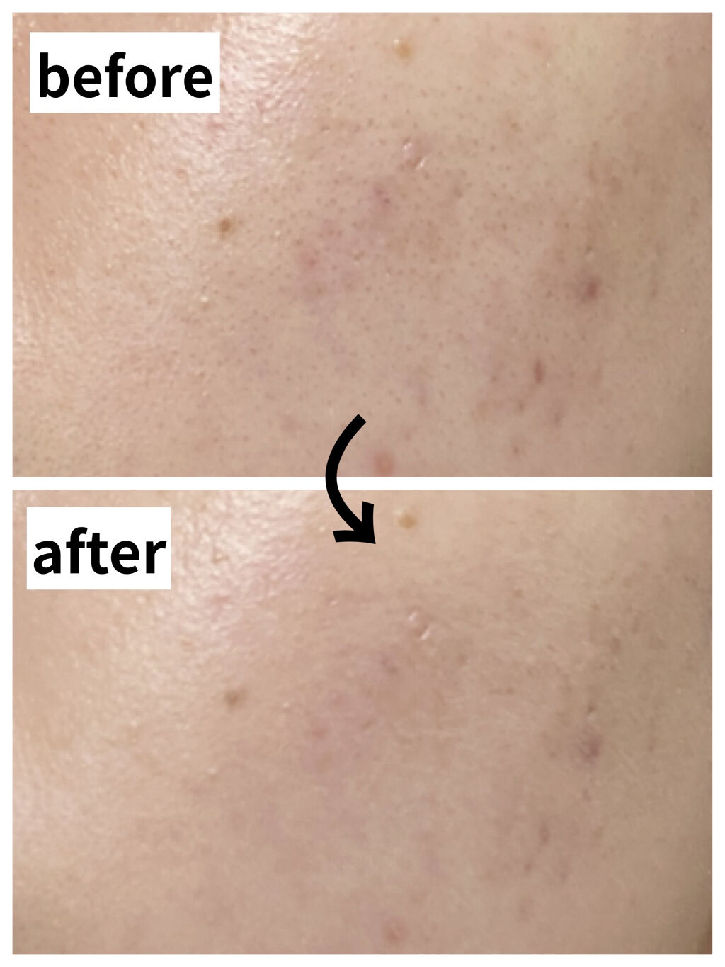 エテュセ フェイスエディション（スキンベース）フォードライスキン/ettusais/化粧下地を使ったクチコミ（3枚目）