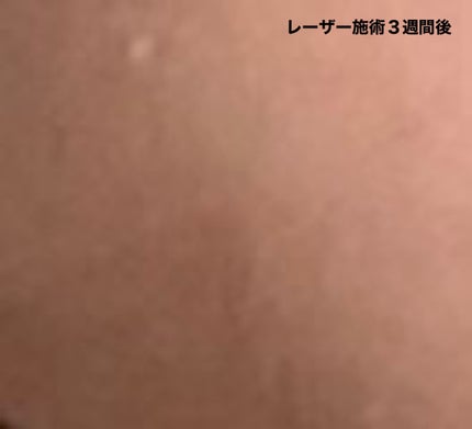 シードナイトクリーム/SEED-D/フェイスクリームを使ったクチコミ(6枚目)