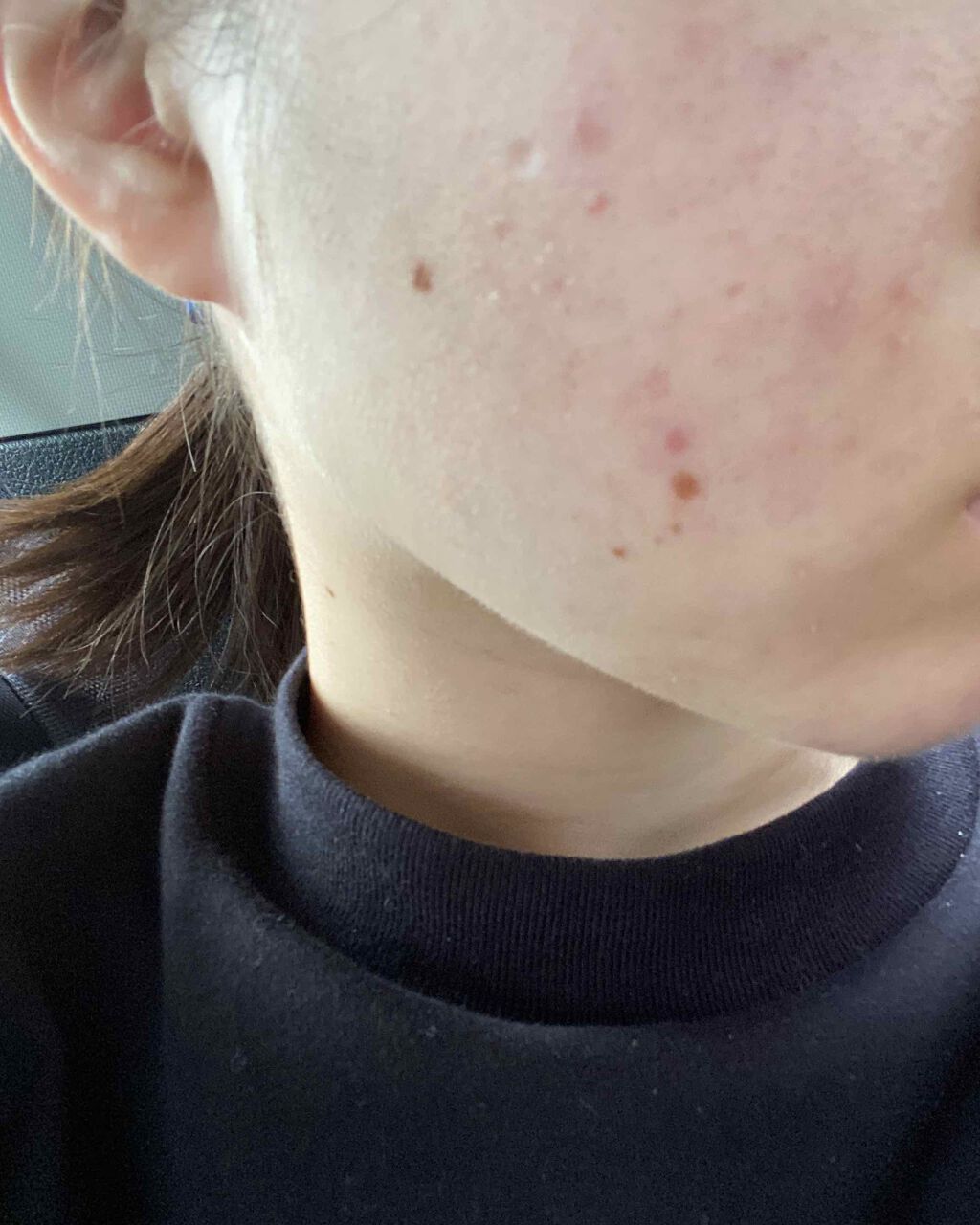 潤浸保湿 フェイスクリーム/キュレル/フェイスクリームを使ったクチコミ（2枚目）