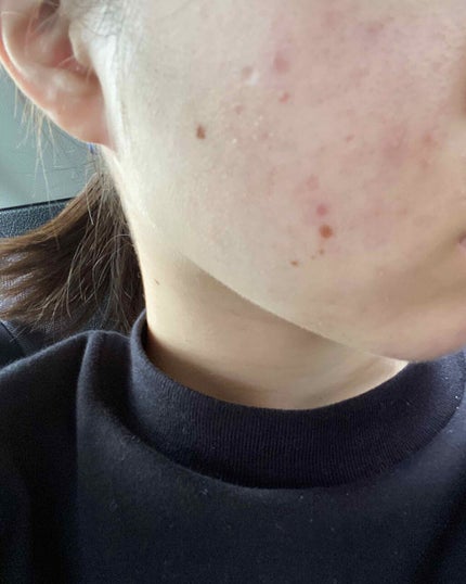 潤浸保湿 フェイスクリーム/キュレル/フェイスクリームを使ったクチコミ(2枚目)