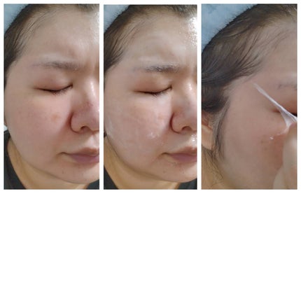 エクソソーム ペプチド グロウ パック/BloomAge/美容液を使ったクチコミ(7枚目)