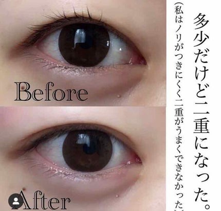 アイトーク スーパーホールド/アイトーク/二重まぶた用アイテムを使ったクチコミ(3枚目)