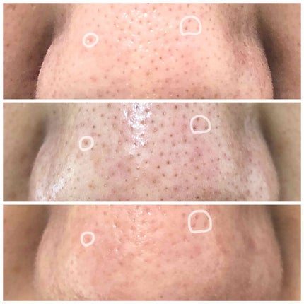 ベビーオイル 無香料/ジョンソンベビー/ボディオイルを使ったクチコミ(4枚目)