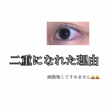 こんにちは‼︎‼︎ふたばです🌱
初投稿なので色々わかりませんがよろしくお願いします😂💦

まず二重になろうと思ったきっかけは、
学校で可愛い子が多く、その子たちはみんな二重で羨ましいなあと思ってました。