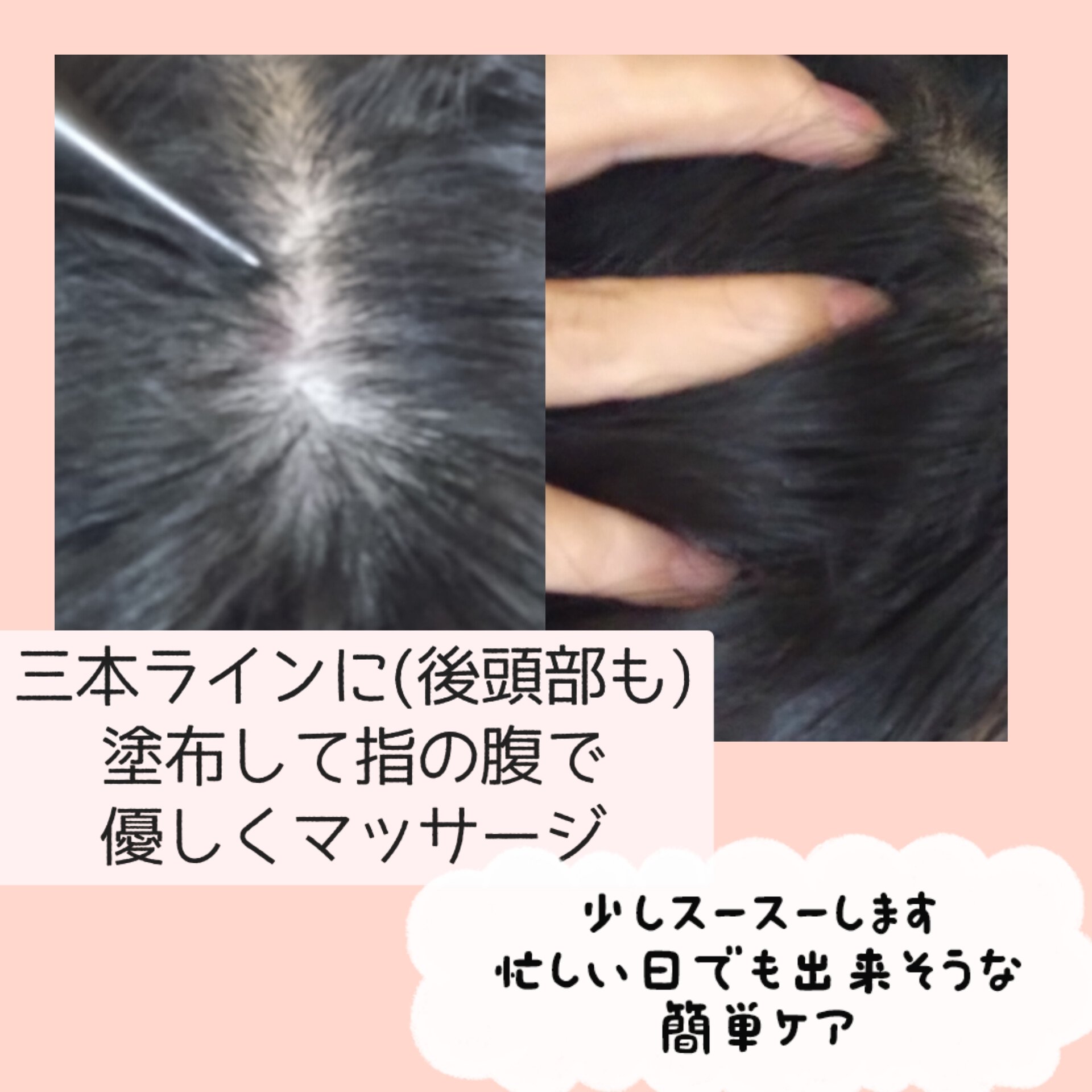 ナノグロウリッチ/iqumore/頭皮ローションを使ったクチコミ（3枚目）