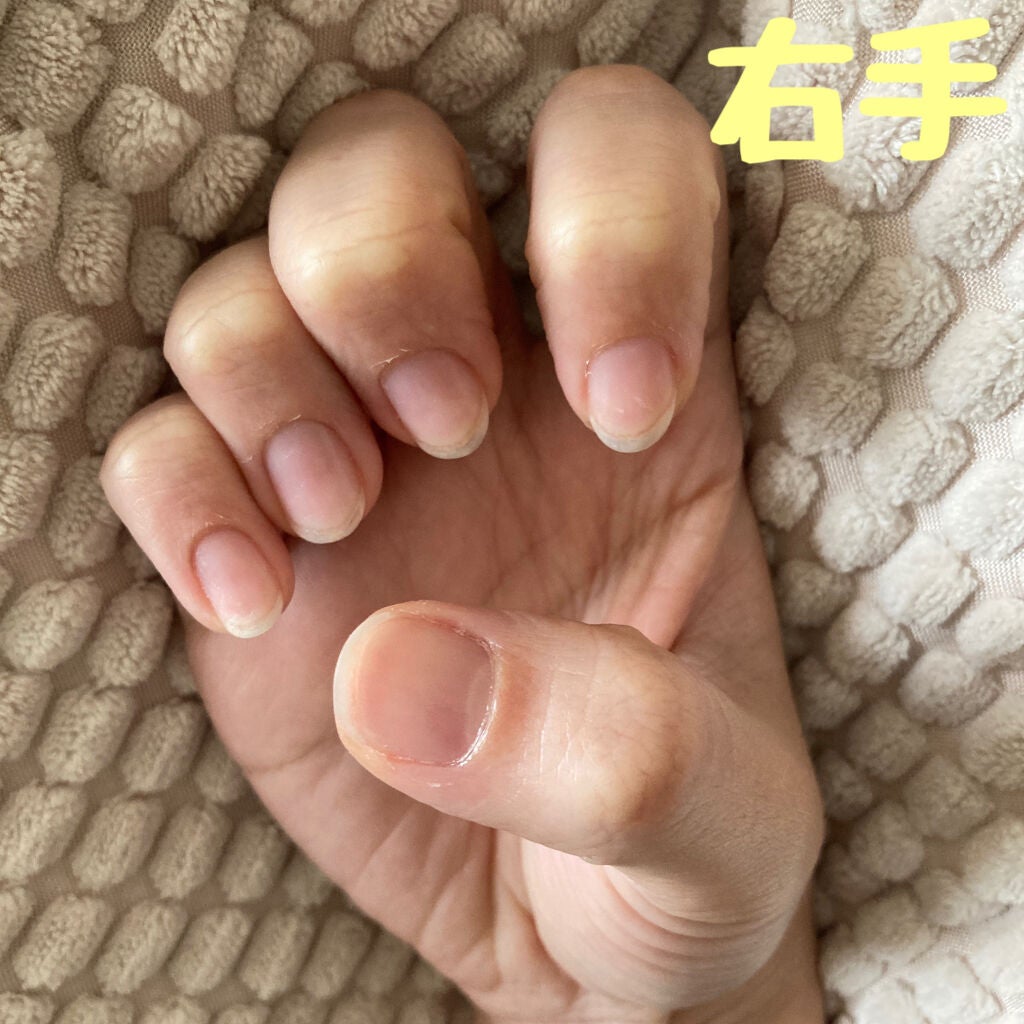 エテュセ クイックケアコート/ettusais/ネイルオイル・トリートメントを使ったクチコミ(2枚目)