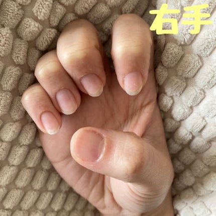 エテュセ クイックケアコート/ettusais/ネイルオイル・トリートメントを使ったクチコミ(2枚目)